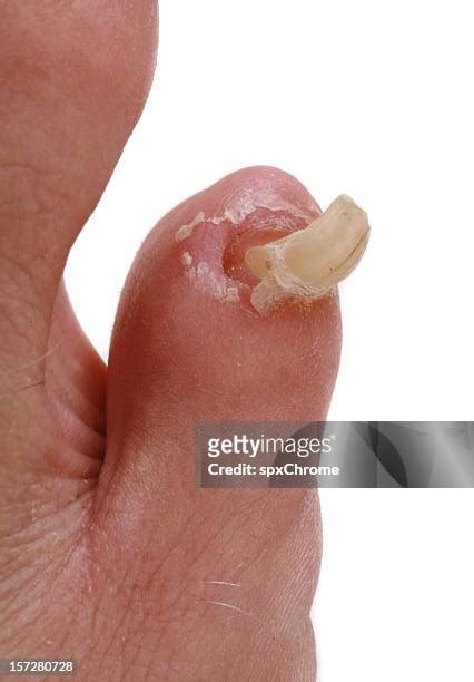 6,900+ Gross Feet Stock Photos, Pictures & Royalty